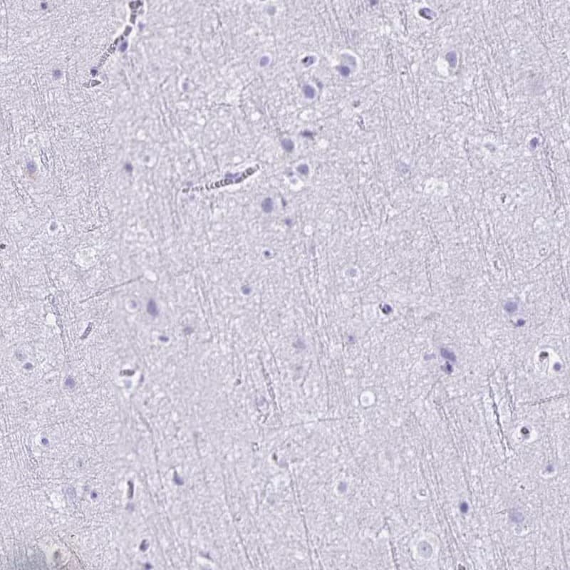 Staining of human cerebral cortex shows low expression as expected.