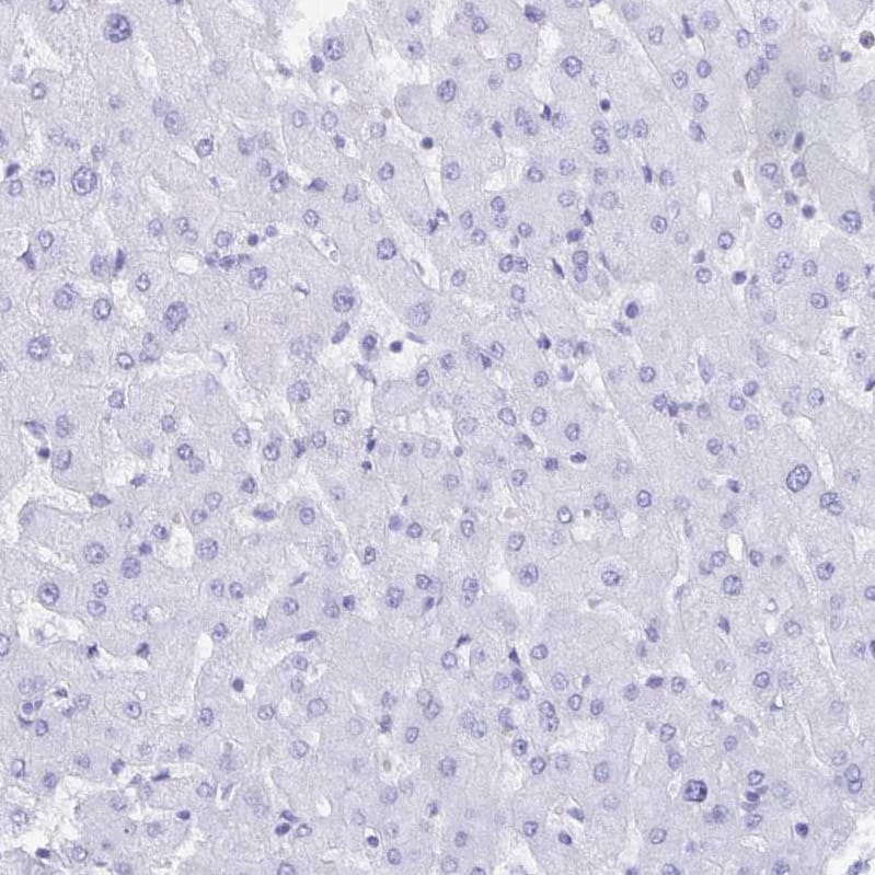 Staining of human liver shows no positivity in hepatocytes as expected.