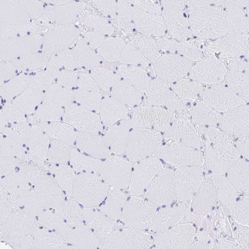 Staining of human skeletal muscle shows no positivity in myocytes as expected.