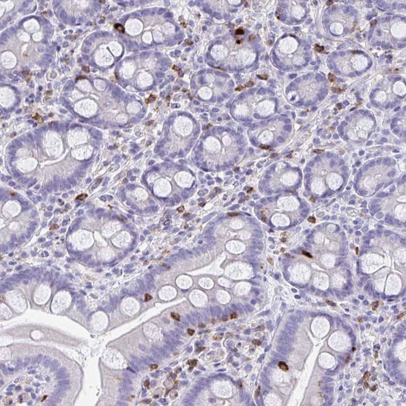 Staining of human small intestine shows strong membranous and cytoplasmic positivity in lymphoid cells.
