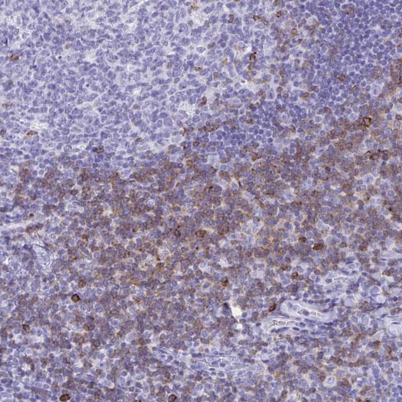 Staining of human tonsil shows strong membranous and cytoplasmic positivity in non-germinal center cells.
