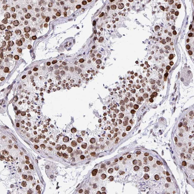 Staining of human testis shows strong nuclear positivity in cells in seminiferous ducts.