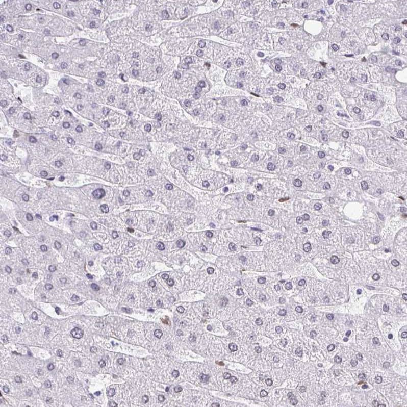 Staining of human liver shows low positivity in hepatocytes as expected.