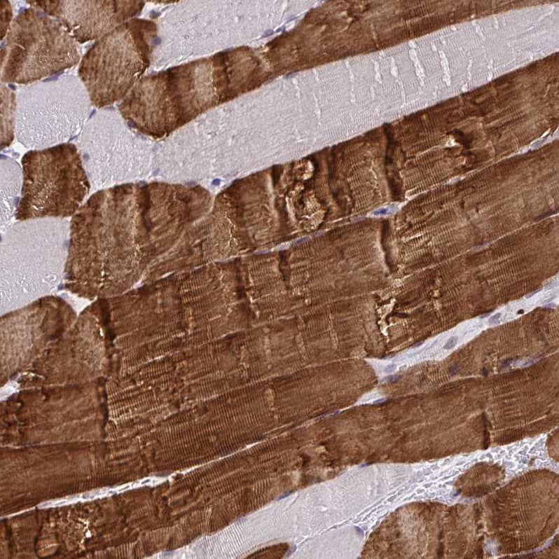Staining of human skeletal muscle shows  strong cytoplasmic positivity in myocytes.