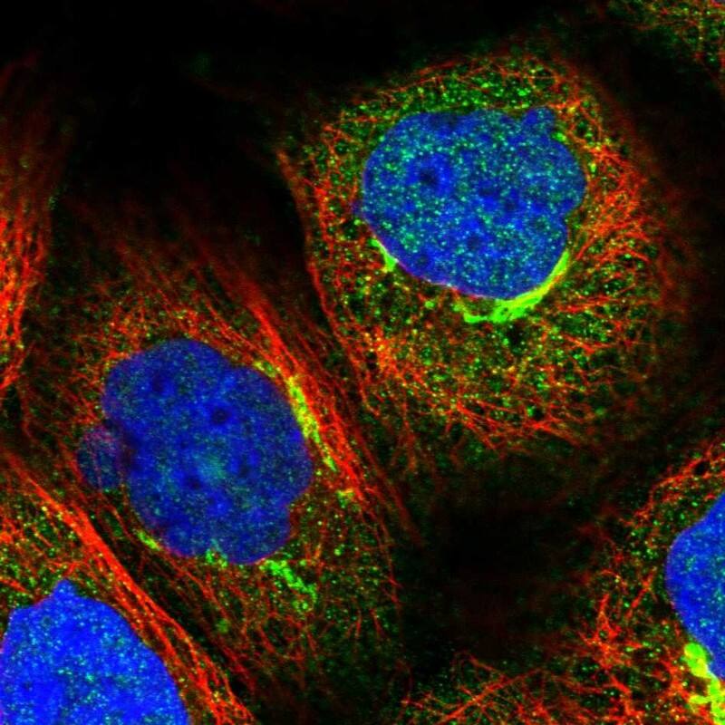 Staining of human cell line A-431 shows localization to cytosol & the Golgi apparatus.
