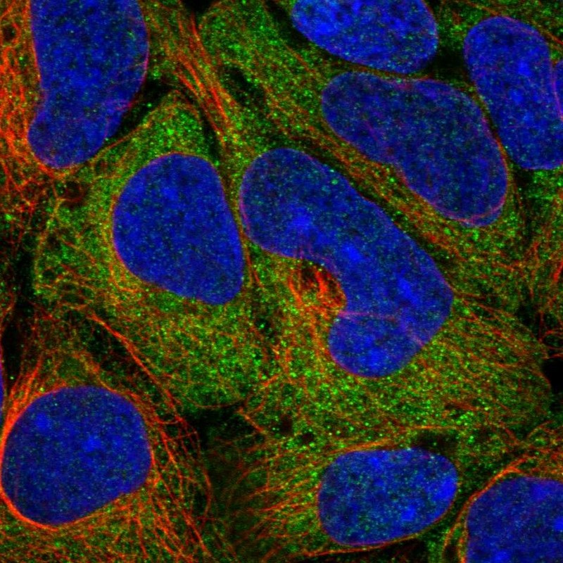 Staining of human cell line HEK 293 shows localization to cytosol.