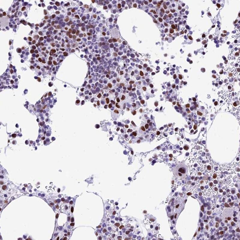 Staining of human bone marrow shows distinct nuclear positivity in hematopoietic cells.
