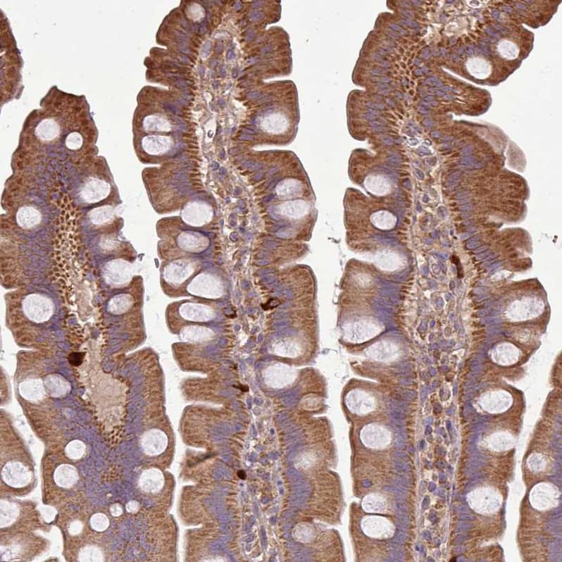 Immunohistochemistry-Paraffin PLEKHM1 Antibody - BSA Free