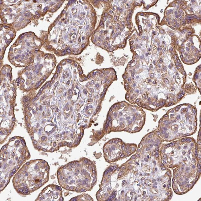 Immunohistochemistry-Paraffin PLEKHM1 Antibody - BSA Free