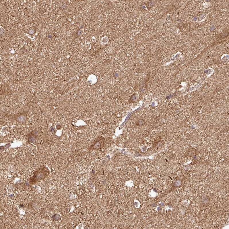 Staining of human cerebral cortex shows moderate positivity in neuropil.
