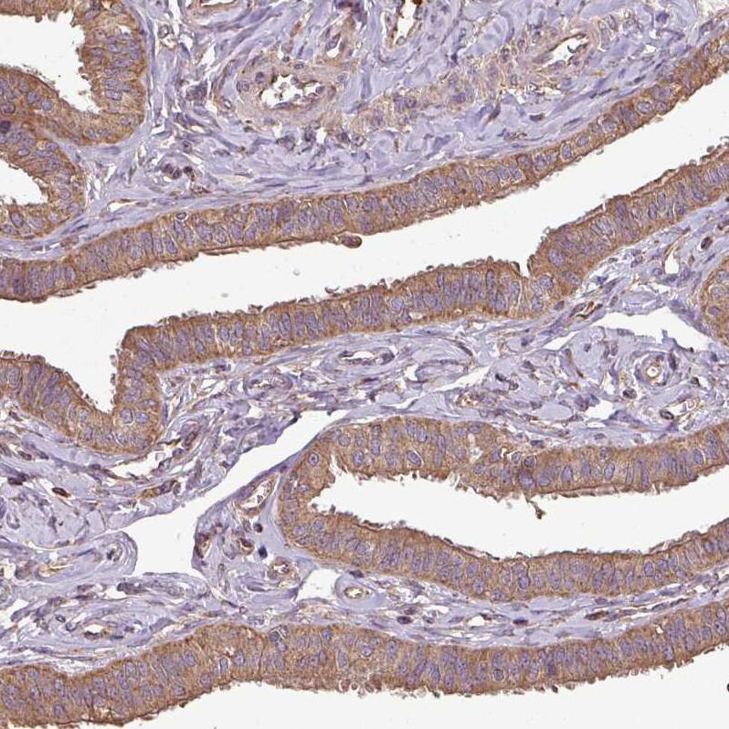 Staining of human Fallopian tube shows moderate cytoplasmic positivity in glandular cells.