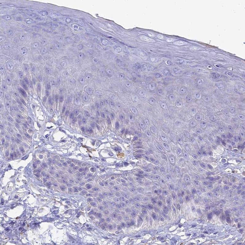 Staining of human skin shows no positivity in keratinocytes.