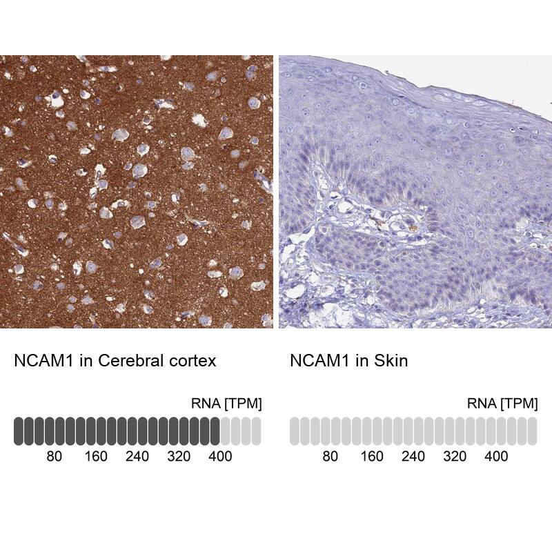 <b>Orthogonal Strategies Validation. </b>Analysis in human cerebral cortex and skin tissues. Corresponding RNA-seq data are presented for the same tissues.
