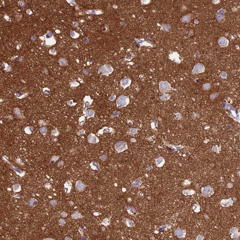 Staining of human cerebral cortex shows strong cytoplasmic positivity in neuropil.