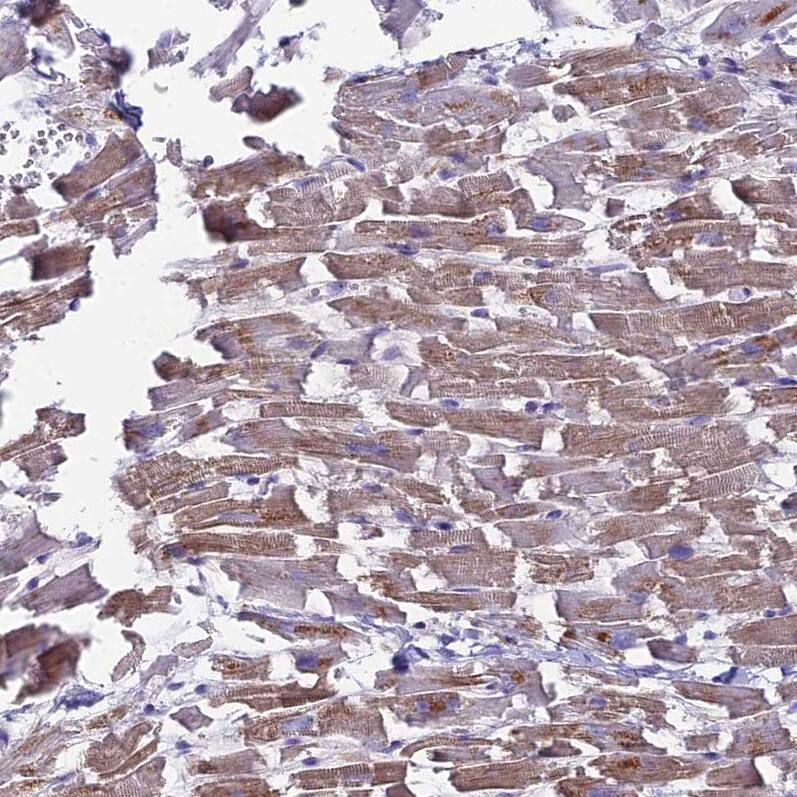 Staining of human heart muscle shows moderate cytoplasmic positivity in cardiomyocytes.