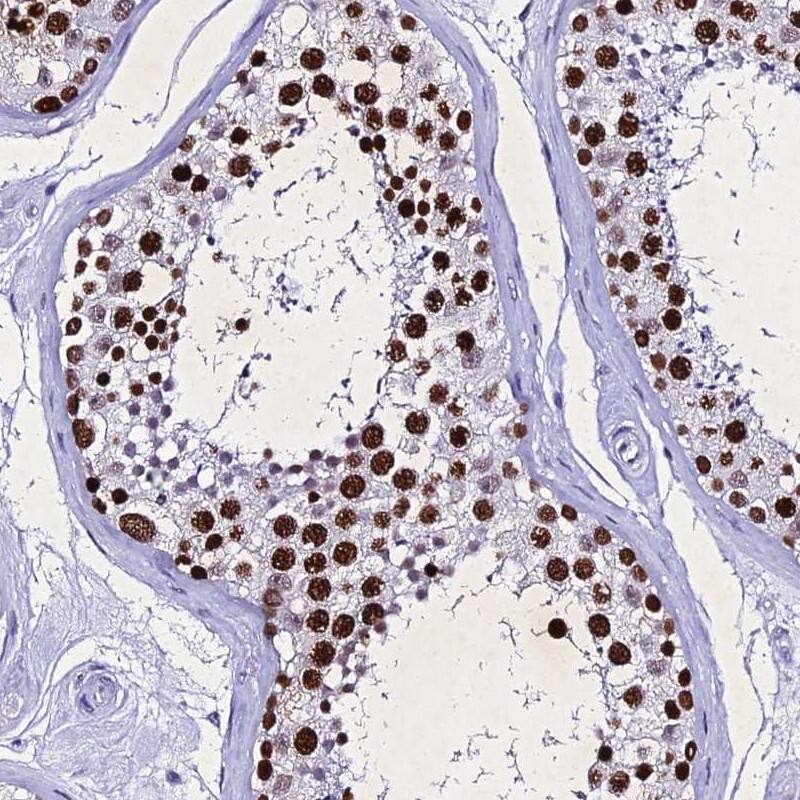 Immunohistochemistry-Paraffin PPP4R2 Antibody - BSA Free