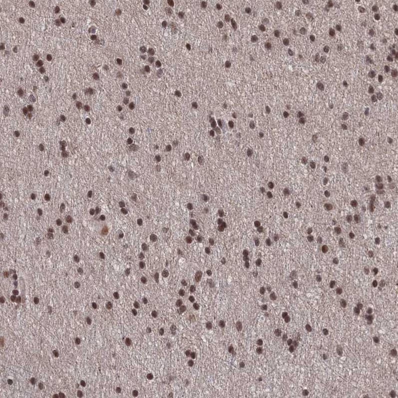 Staining of human cerebral cortex shows strong nuclear positivity in glial cells.