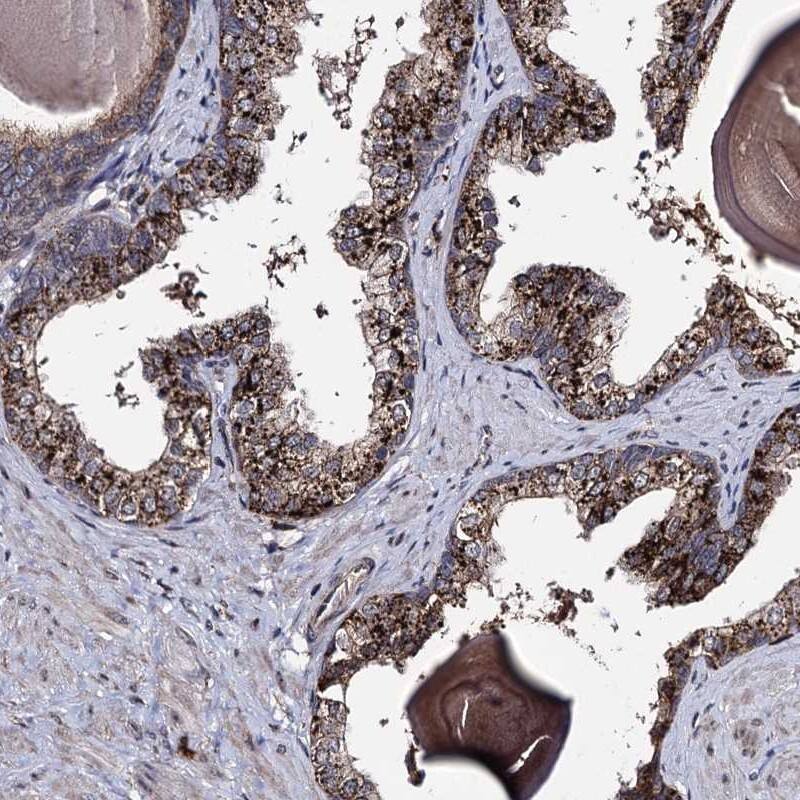 Staining of human prostate shows strong cytoplasmic positivity in glandular cells.