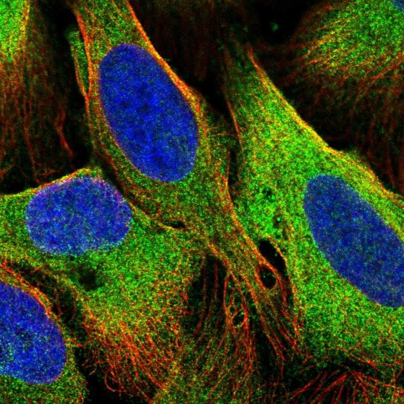 Staining of human cell line U-2 OS shows localization to cytosol.