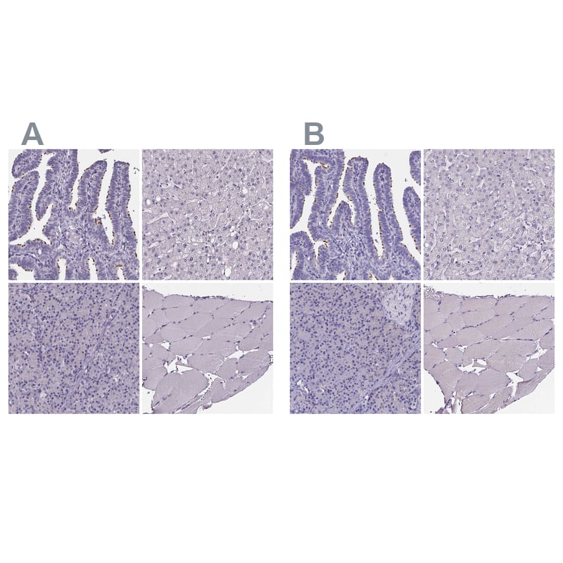 Staining of human fallopian tube, liver, pancreas and skeletal muscle .