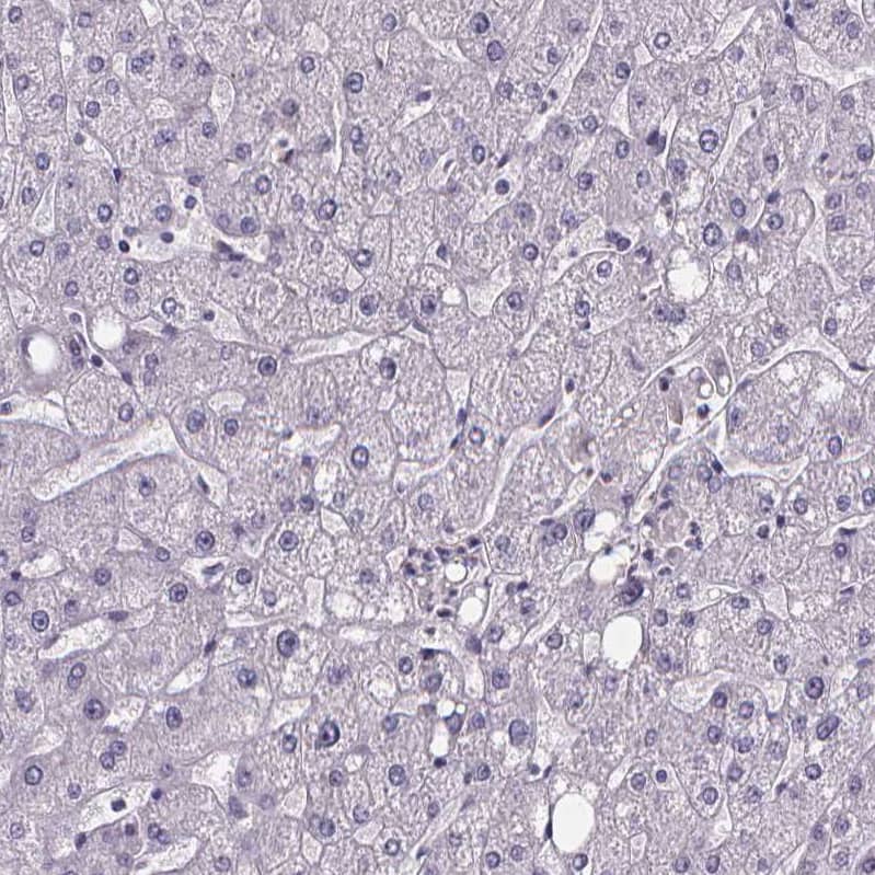 Staining of human liver shows no  positivity in hepatocytes as expected.