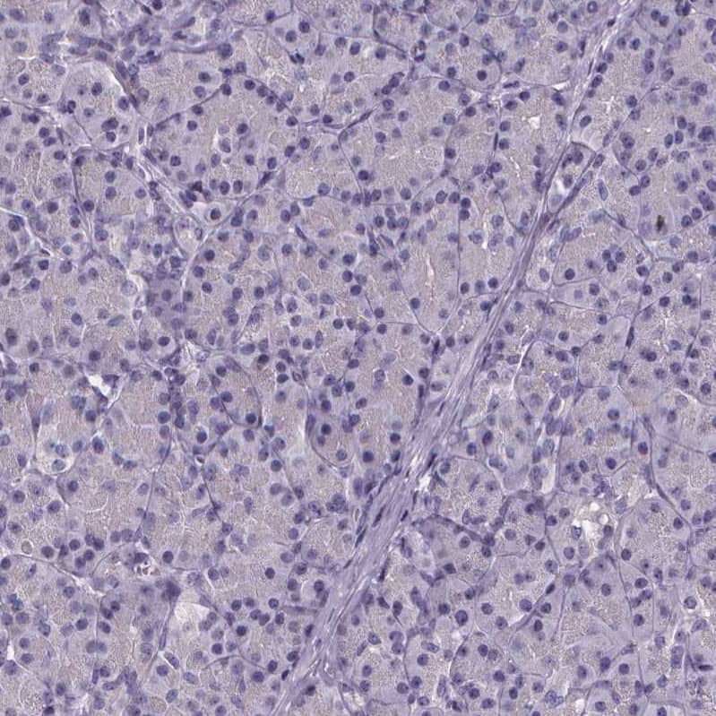 Staining of human pancreas shows no positivity in exocrine glandular cells as expected.