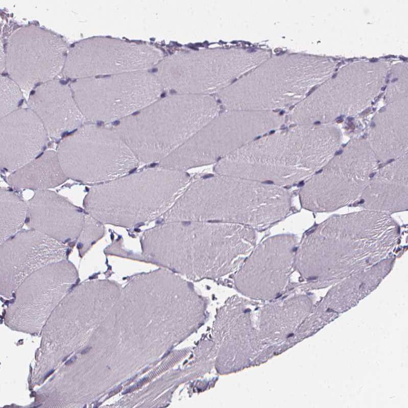Staining of human skeletal muscle shows no positivity in myocytes as expected.