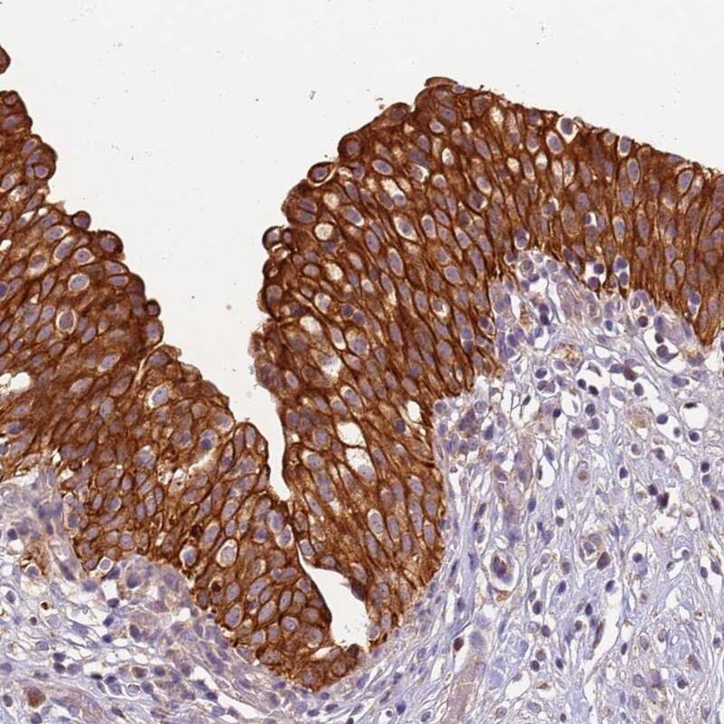 Staining of human urinary bladder shows strong cytoplasmic and membranous positivity in urothelial cells.