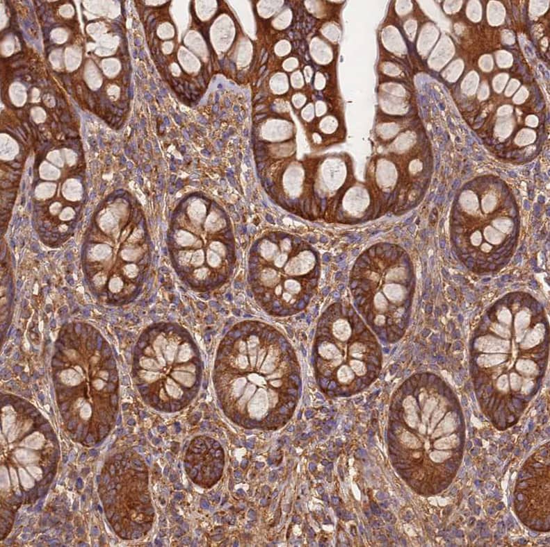 Immunohistochemistry-Paraffin DYNC1I2 Antibody - BSA Free