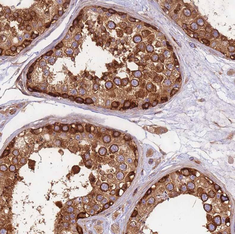 Staining of human testis shows strong cytoplasmic positivity in cells in seminiferous ducts.
