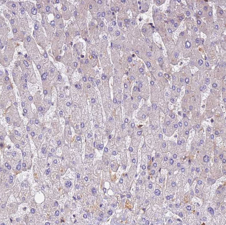 Staining of human liver shows no positivity in hepatocytes.