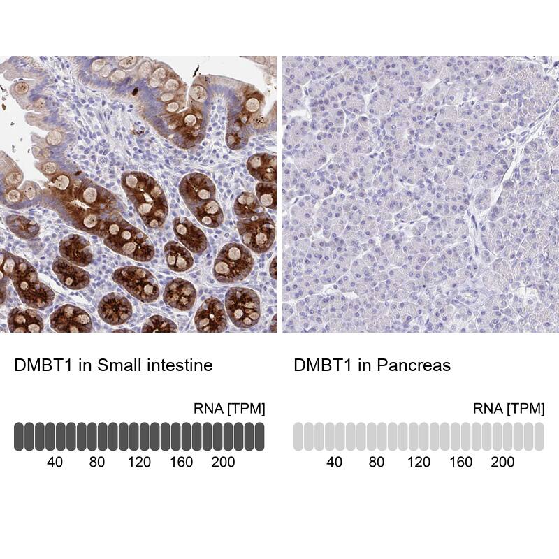 <b>Orthogonal Strategies Validation. </b>Analysis in human small intestine and pancreas tissues. Corresponding RNA-seq data are presented for the same tissues.