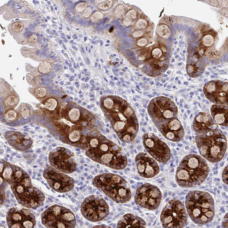 Staining of human small intestine shows moderate positivity in extracellular matrix in glandular cells.