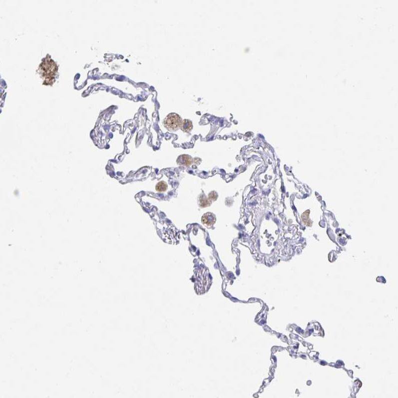 Staining of human lung shows weak positivity in extracellular matrix in macrophages.