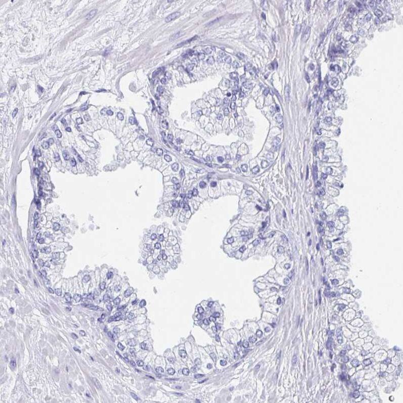 Staining of human prostate shows no positivity in glandular cells as expected.