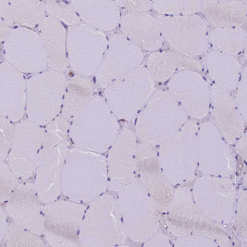 Immunohistochemistry-Paraffin CDAN1 Antibody - BSA Free
