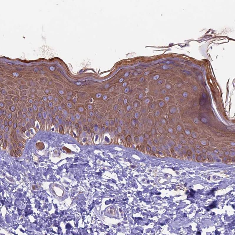 Staining of human skin shows moderate cytoplasmic positivity in glandular cells.