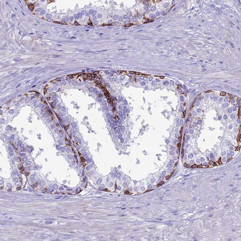 Staining of human prostate shows strong membranous positivity in glandular cells.