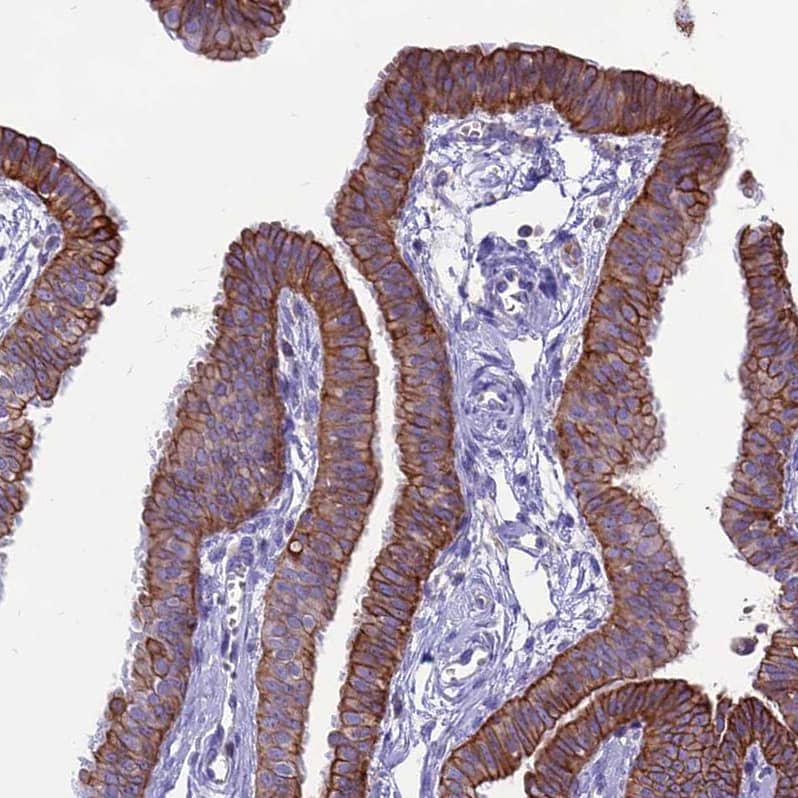 Staining of human Fallopian tube shows strong membranous positivity in glandular cells.