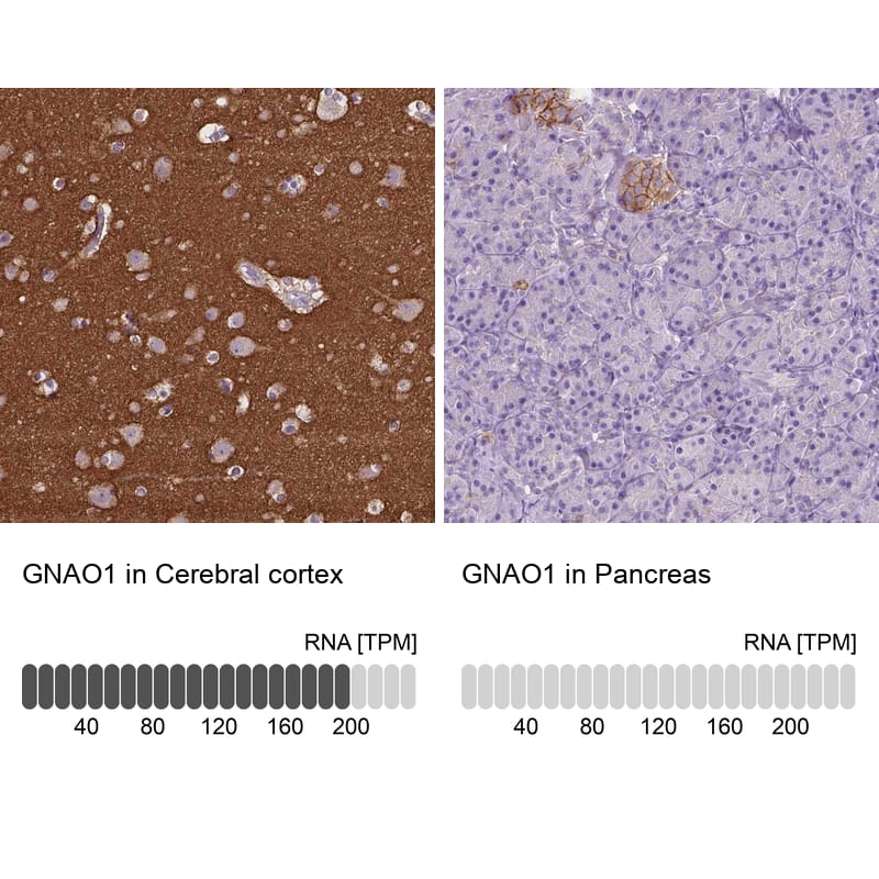 <b>Orthogonal Strategies Validation. </b>Analysis in human cerebral cortex and pancreas tissues.