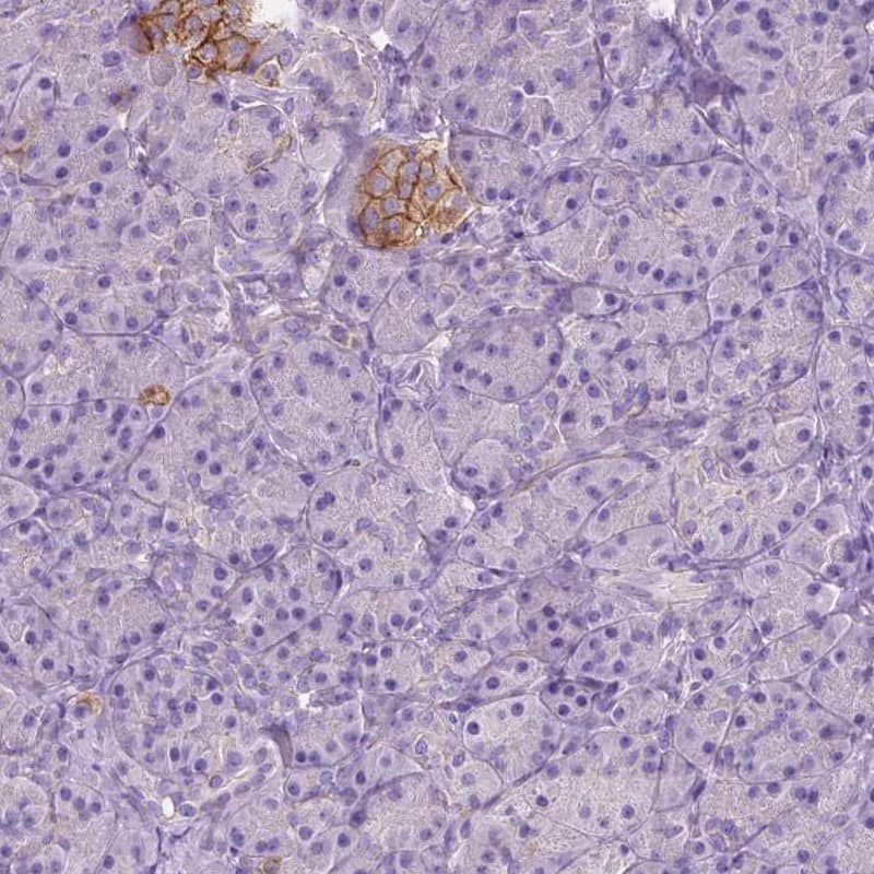 Staining of human pancreas shows low expression as expected.