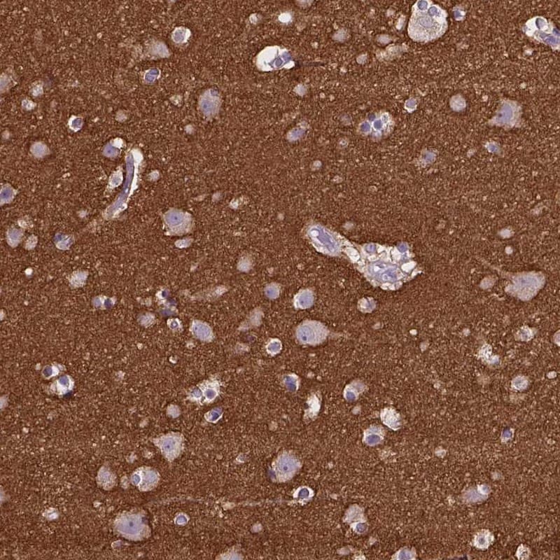 Staining of human cerebral cortex shows high expression.