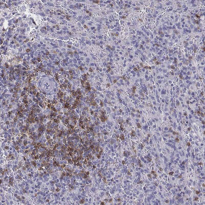 Staining of human spleen shows weak to moderate cytoplasmic positivity in cells in red pulp.
