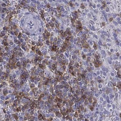 Staining of human spleen.