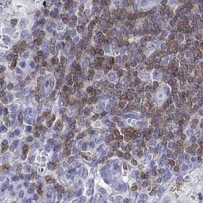 Staining of human lymph node.