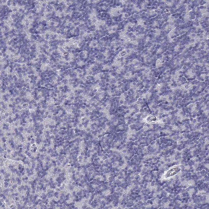 Staining of human purkinje layer of the cerebellum shows no cytoplasmic positivity as expected.