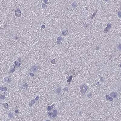 Staining of human cerebral cortex.