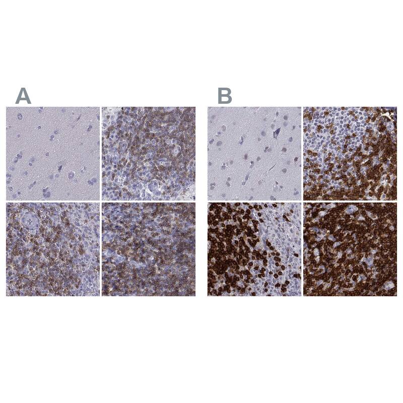 <b>Orthogonal Strategies Validation. </b>Staining of human cerebral cortex, lymph node, spleen and tonsil HPA040957 (A) shows similar protein distribution across tissues to independent antibody HPA043955 (B).
