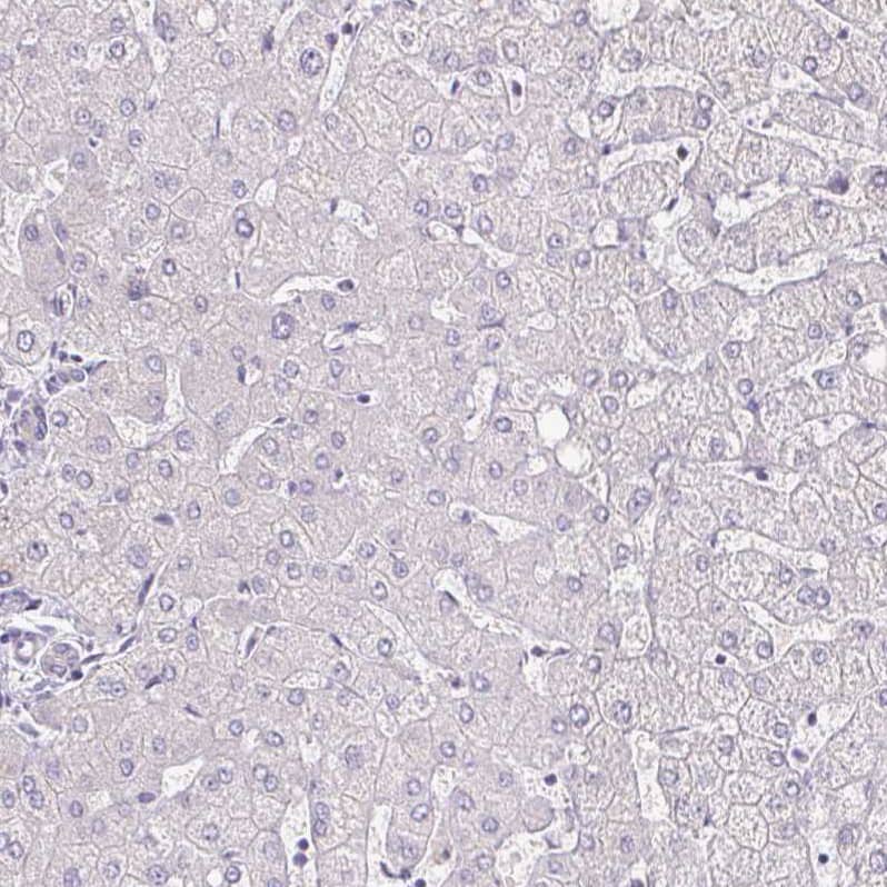 Staining of human liver shows no cytoplasmic positivity in hepatocytes.