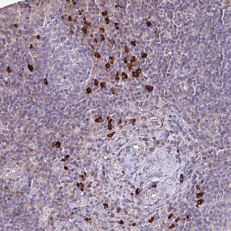 Staining of human lymph node shows strong cytoplasmic positivity in non-germinal center cells.